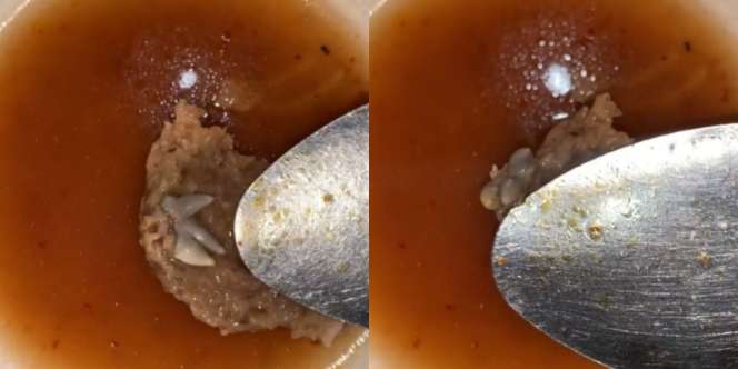 Makan Bakso Semangkok Tinggal Suapan Terakhir, Perut Mendadak Mual Lihat Benda Mirip Kaki Tikus di Dagingnya