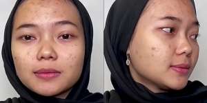Wajah Pengantin Penuh Jerawat Ini Seketika Berubah Drastis Usai Dirias MUA, Ternyata Begini Hasilnya…
