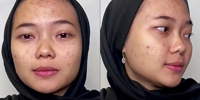 Wajah Pengantin Penuh Jerawat Ini Seketika Berubah Drastis Usai Dirias MUA, Ternyata Begini Hasilnya…