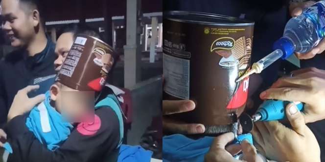Kaleng Wafer Tersangkut di Kepala Bocah dari Tasikmalaya, Damkar Sampai Turun Tangan