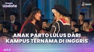 Gaya Amanda Caesa Anak Parto Patrio, Lulus dari Kampus Ternama di Inggris, Dipuji Bak Barbie!