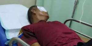 Fakta-Fakta Orangtua Siswa Ketapel Mata Guru di Bengkulu, Berujung Saling Lapor