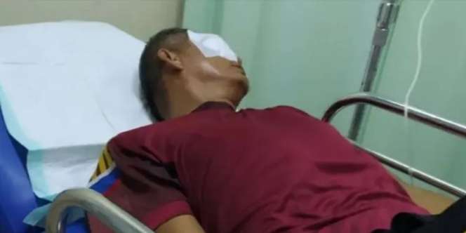 Fakta-Fakta Orangtua Siswa Ketapel Mata Guru di Bengkulu, Berujung Saling Lapor