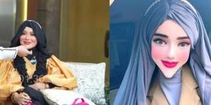 Potret Yuni Jasmine PNS Viral Berdagu Lancip, Wajah Aslinya Dibongkar Dr. Richard Lee