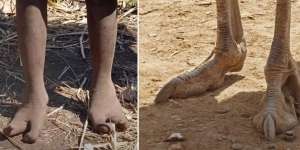 Suku di Afrika Ini Andal Berburu Tapi Lahir dengan Kaki Seperti Burung Unta