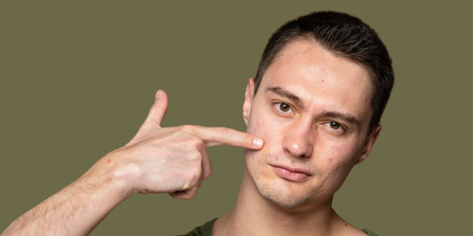 Bukan Cuma Malas Cuci Muka, Ini Penyebab Pria Berjerawat