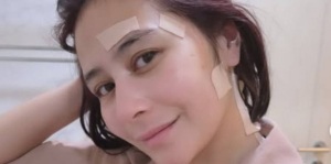 Potret Tak Biasa Prilly Latuconsina, Pede Meski Pakai Banyak Koyo 