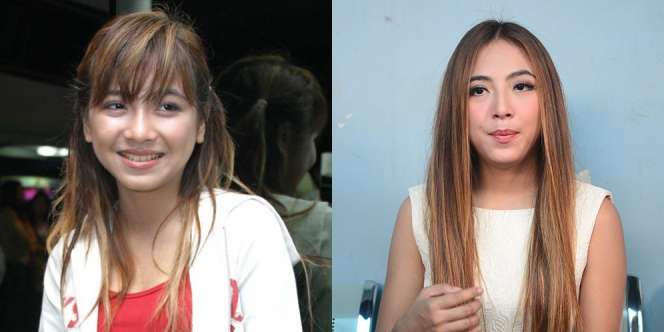 Dulu Biasa Saja, Penampilan 5 Artis Ini Kini Makin Cantik
