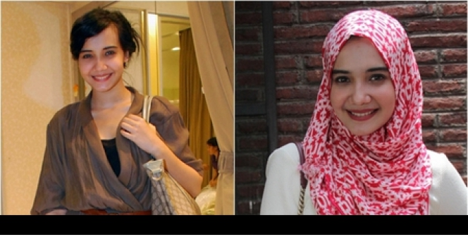 Foto `Before-After` Seleb Cantik Berhijab