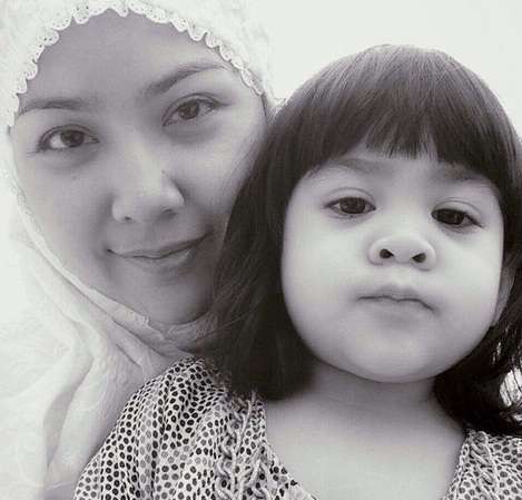 Detik-detik Perjuangan Balita Cantik Ashira Melawan Tumor