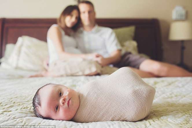 Potret Kebahagiaan Bayi Cantik Down Syndrome