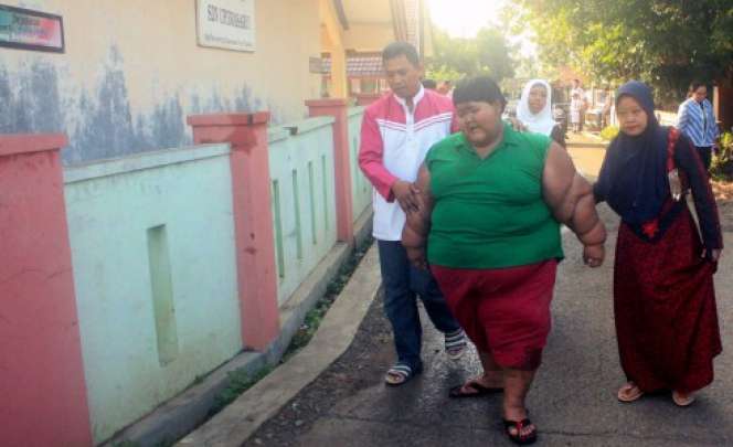 Arya Bocah Obesitas Kembali ke Sekolah