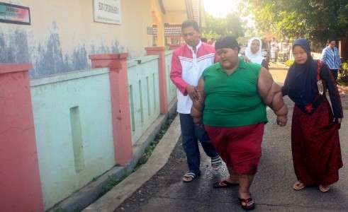 Arya Bocah Obesitas Kembali ke Sekolah