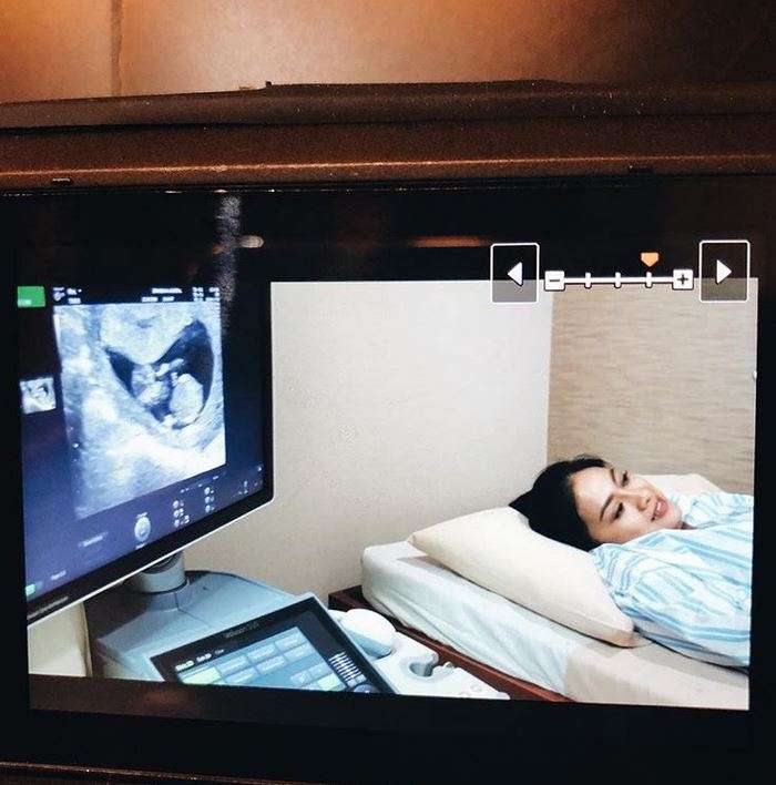 4 Tahun Nikah dengan Mualaf Korea, Rini Yulianti Hamil