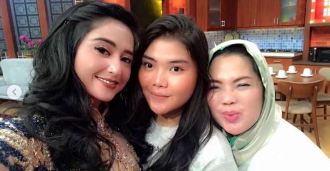 Rosa Meldianti, Keponakan Dewi Perssik yang Jago Goyang