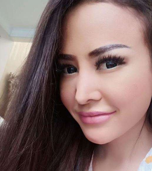5 Artis Cantik Ini Akui Pernah Permak Bagian Wajah