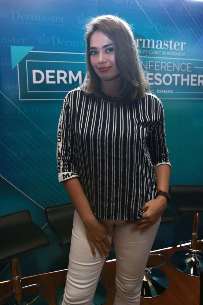 Catherine Wilson Ungkap Alasan Terima Mobil dari Wawan