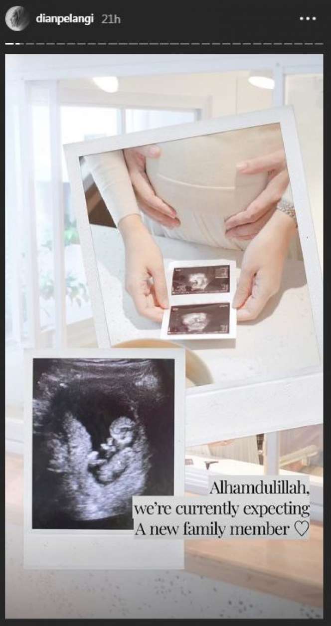 Potret Bahagia Dian Pelangi Umumkan Kehamilan Anak Pertama