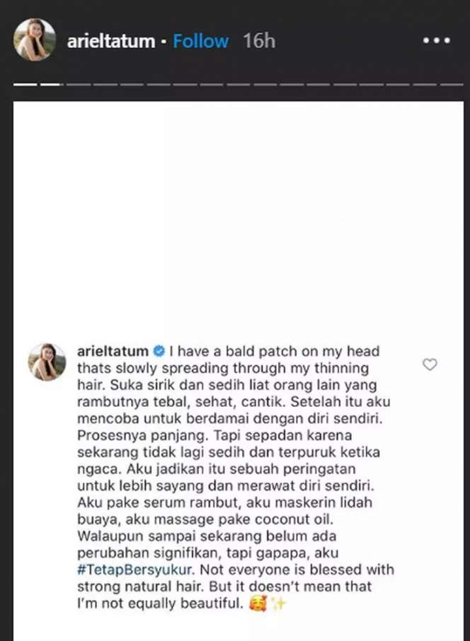 Jangan Minder! Ini Pesan Ariel Tatum Soal Standar Kecantikan