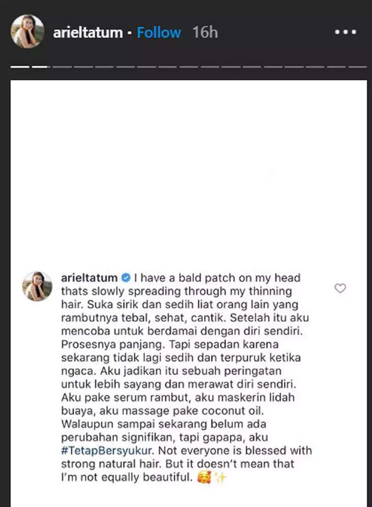 Jangan Minder! Ini Pesan Ariel Tatum Soal Standar Kecantikan