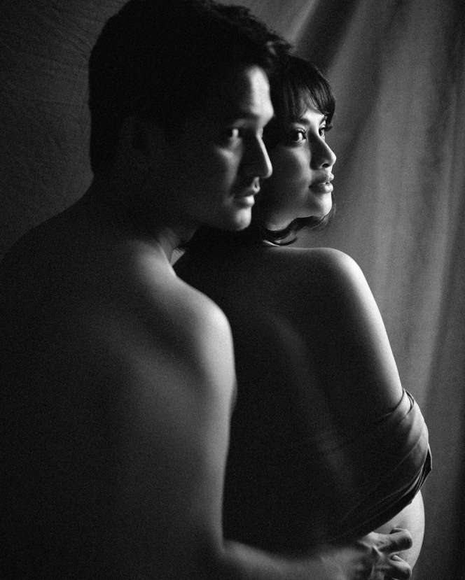 Hamil Tua, Vanessa Angel Pamer Foto Topless Bareng Suami