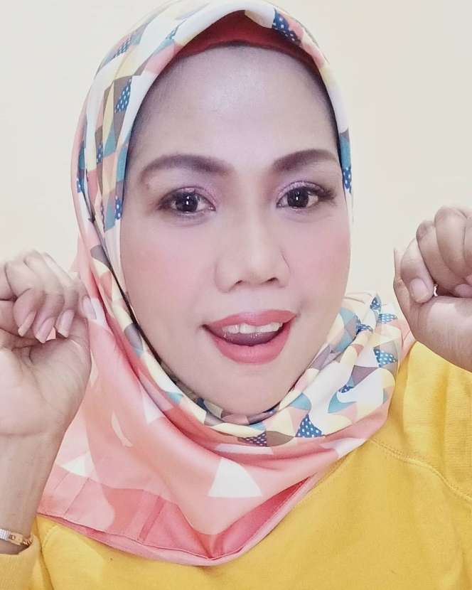 6 Potret Anyar Elly Sugigi Usai Potong Gigi & Kencangkan Kulit