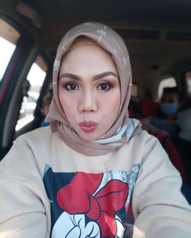 6 Potret Anyar Elly Sugigi Usai Potong Gigi & Kencangkan Kulit