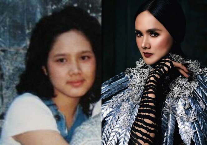 Mengintip 6 Potret Wajah Seleb Sebelum dan Sesudah Terkenal