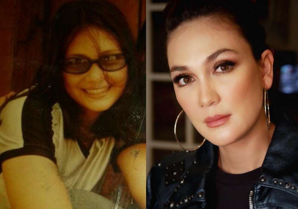 Mengintip 6 Potret Wajah Seleb Sebelum dan Sesudah Terkenal
