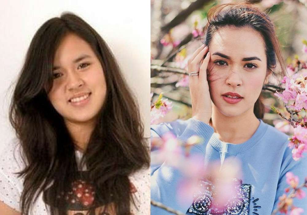 Mengintip 6 Potret Wajah Seleb Sebelum dan Sesudah Terkenal