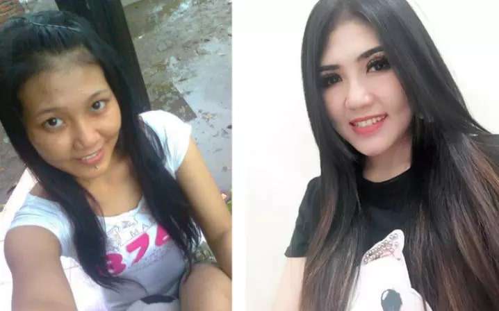 Mengintip 6 Potret Wajah Seleb Sebelum dan Sesudah Terkenal