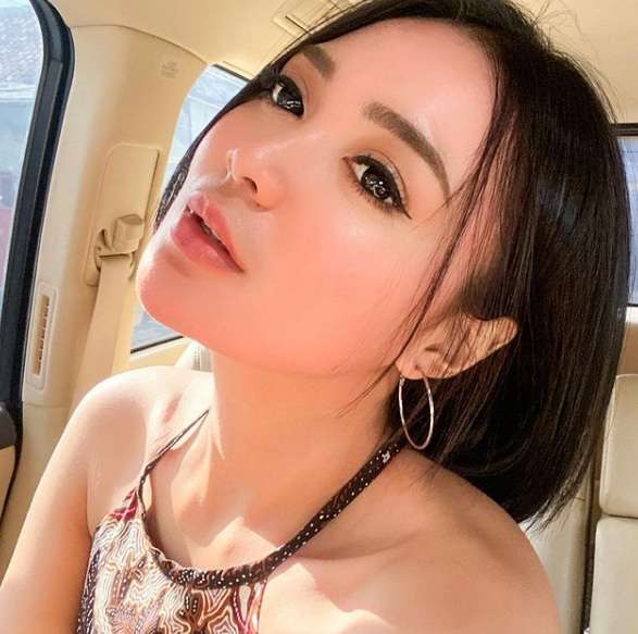 Tiga Seleb Cantik Ini Pamer Bekas Tanda Merah di Tubuh