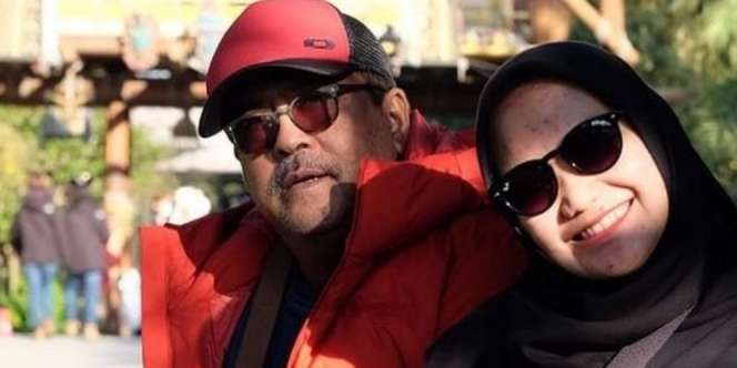 FOTO: Rano Karno Hidup Tanpa Empedu, Pasang 3 Ring di Jantung