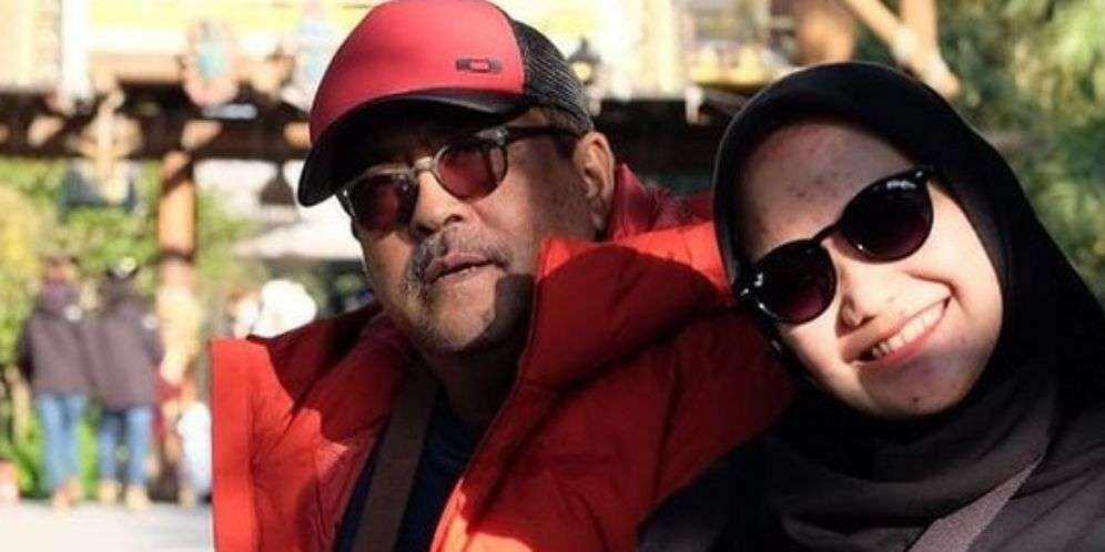 FOTO: Rano Karno Hidup Tanpa Empedu, Pasang 3 Ring di Jantung