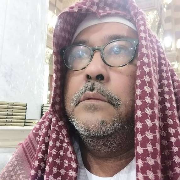 FOTO: Rano Karno Hidup Tanpa Empedu, Pasang 3 Ring di Jantung