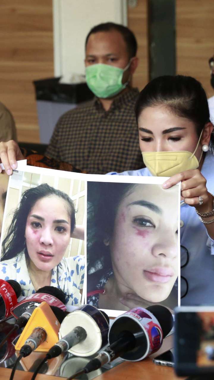 Nindy Ayunda Bongkar 'Borok' Suami