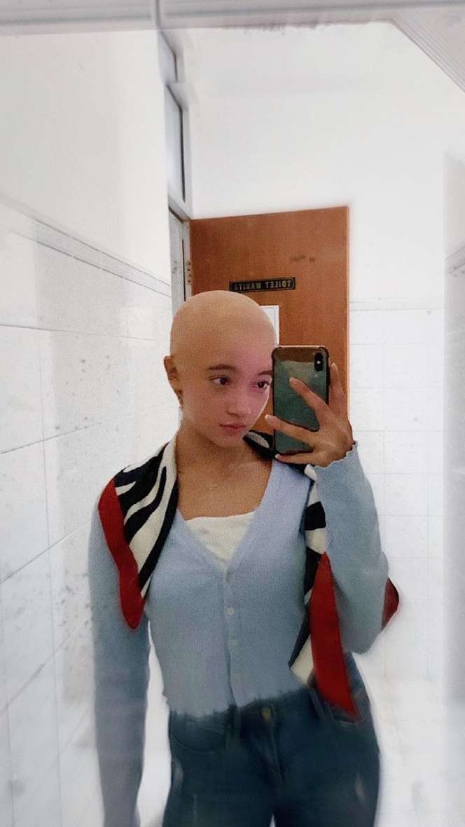 Potret Megan Domani Tampil Botak Plontos 