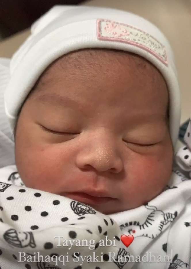 8 Potret Bayi Rizki DA dan Nadya Mustika, Bagian Wajah Disorot