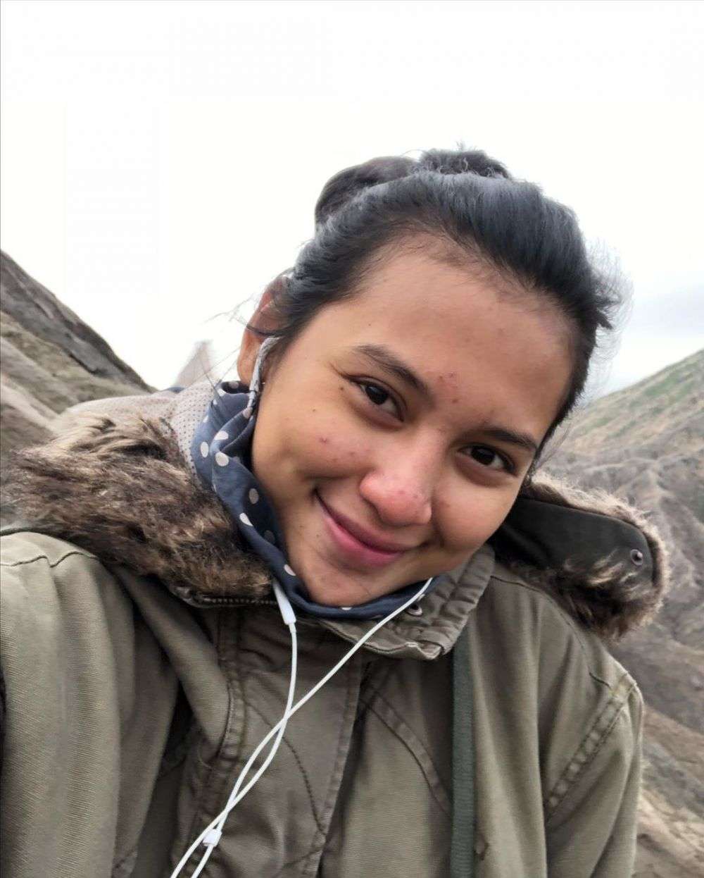 8 Seleb Cantik Tak Segan Pamer Wajah Berjerawat, Tuai Pujian!