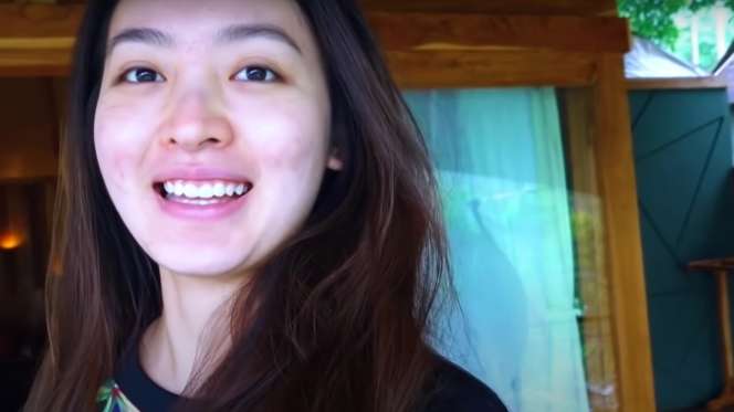 8 Seleb Cantik Tak Segan Pamer Wajah Berjerawat, Tuai Pujian!