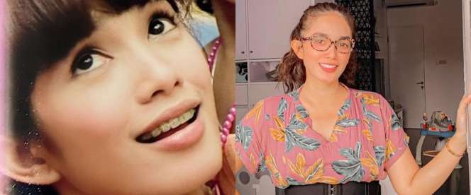 7 Seleb Ini Ternyata Pernah Pakai Behel, Luna Maya Manglingi!