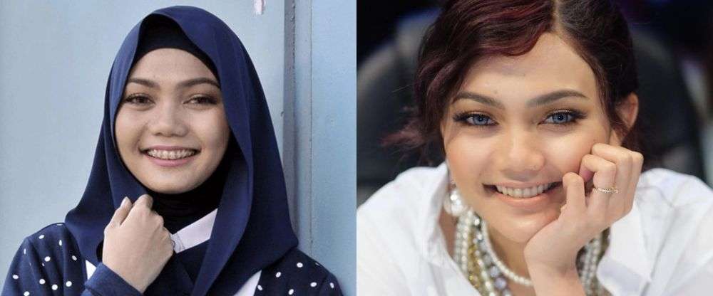 7 Seleb Ini Ternyata Pernah Pakai Behel, Luna Maya Manglingi!