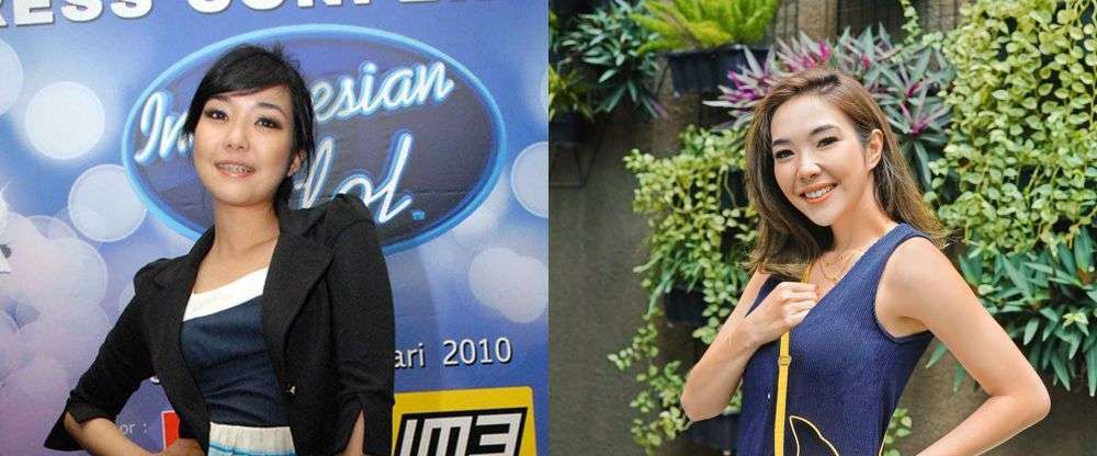 7 Seleb Ini Ternyata Pernah Pakai Behel, Luna Maya Manglingi!