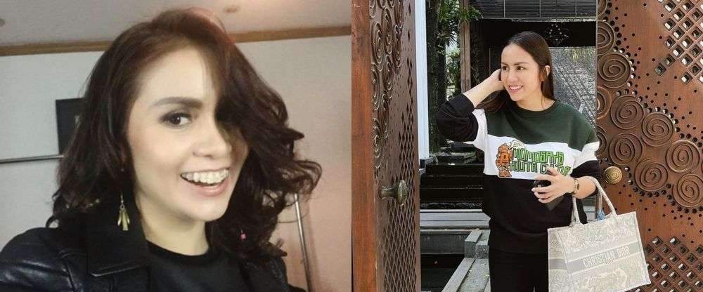 7 Seleb Ini Ternyata Pernah Pakai Behel, Luna Maya Manglingi!