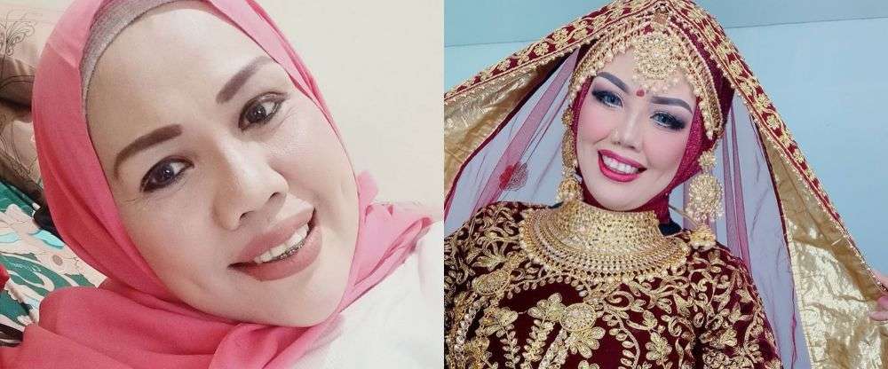 7 Seleb Ini Ternyata Pernah Pakai Behel, Luna Maya Manglingi!