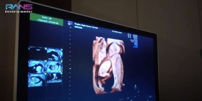 Momen Bahagia Nagita Slavina Cek Kandungan Ditemani Rafathar