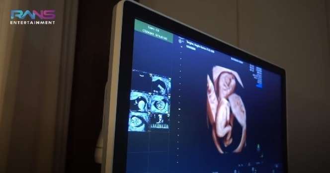 Momen Bahagia Nagita Slavina Cek Kandungan Ditemani Rafathar