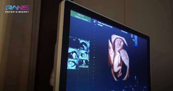 Momen Bahagia Nagita Slavina Cek Kandungan Ditemani Rafathar