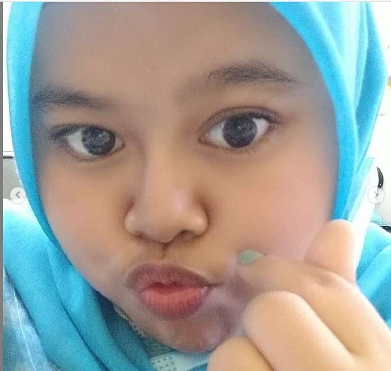 Potret Kekeyi Setelah Filler Hidung, Foto Before-After Viral
