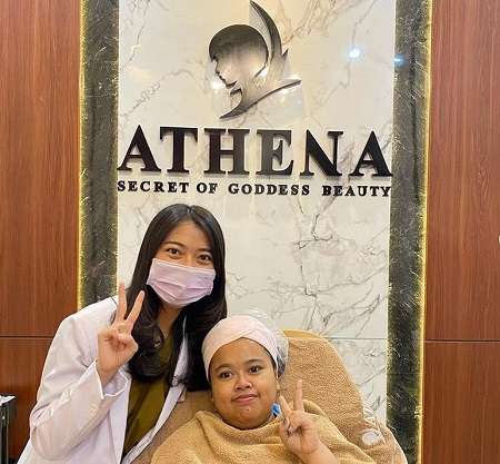 Potret Kekeyi Setelah Filler Hidung, Foto Before-After Viral